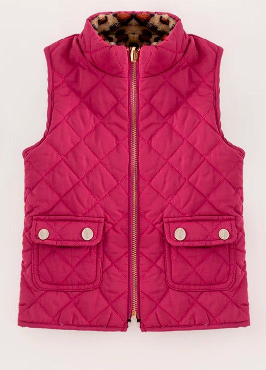 Fuchsia Reversible Vest